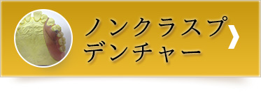 ノンクラスプデンチャー